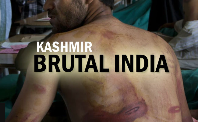Kashmir: India an inherently autocratic Country!